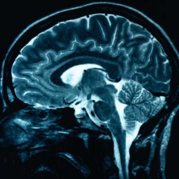 [Image of a human brain]