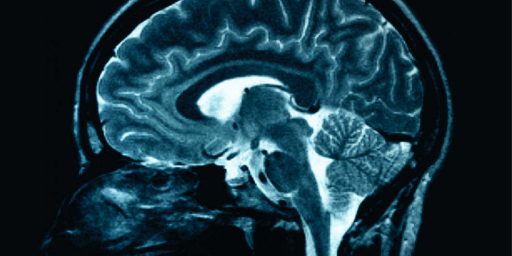 [Image of a human brain]